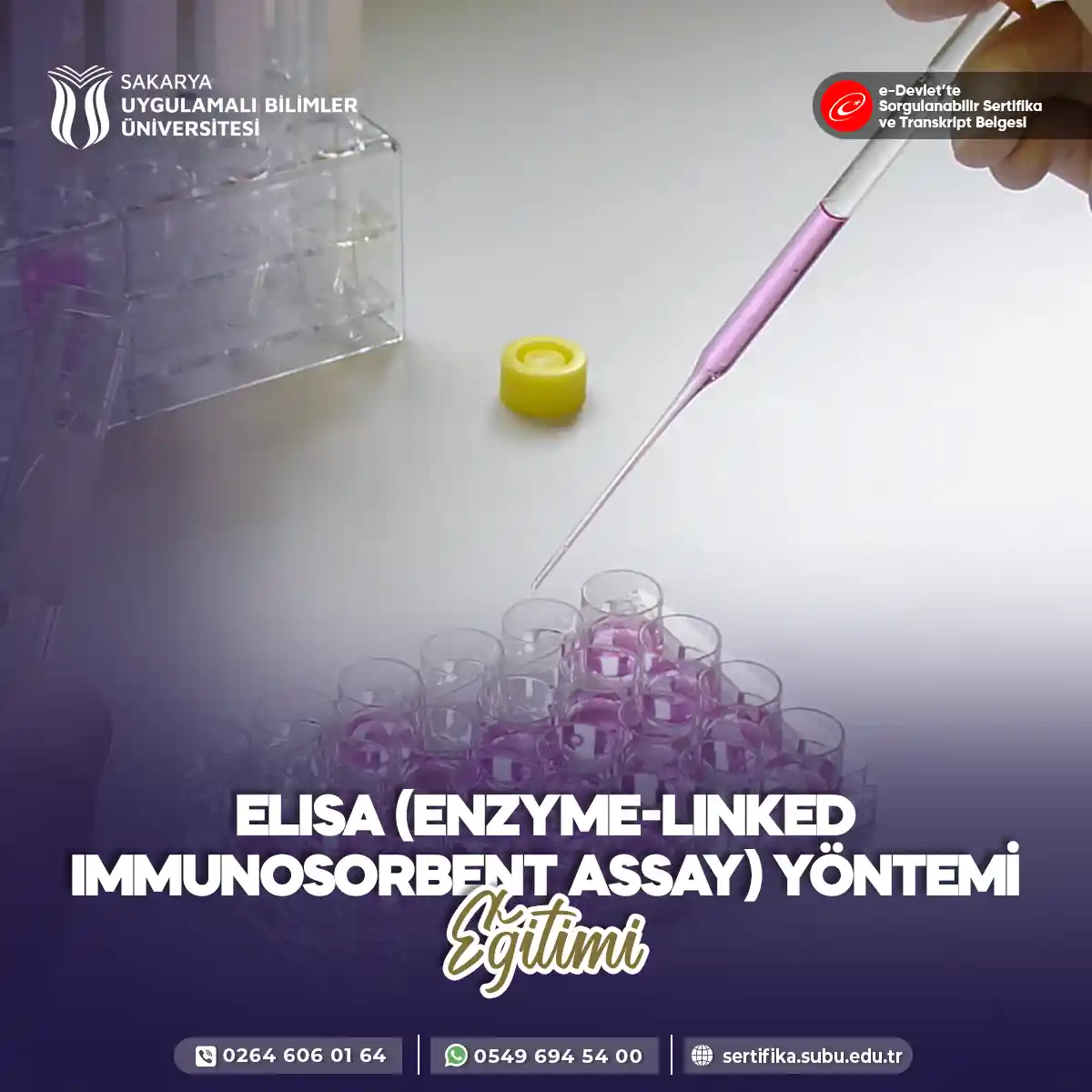 ELISA (Enzyme-Linked Immunosorbent Assay) Yöntemi Eğitimi